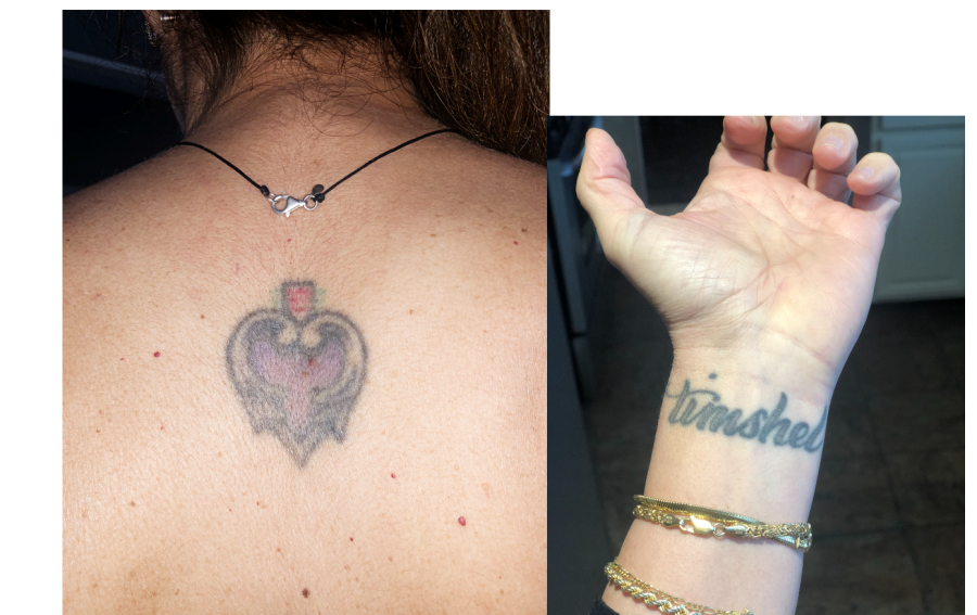 Dyan Naslund’s purple heart tattoo on her back is a tribute to her father. She also has the word “timshel” tattooed on her wrist, which represents “free will.”
